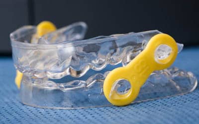 Photo of the Myerson Elastic Mandibular Advancement oral appliance for sleep apnea. The appliance is made of clear plastic and has a yellow hinge on either side. The appliance is available from Cheek Dental in East Cobb, GA.