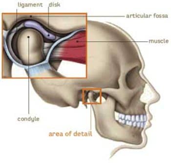 An illustration with a close up of a TMJ Joint