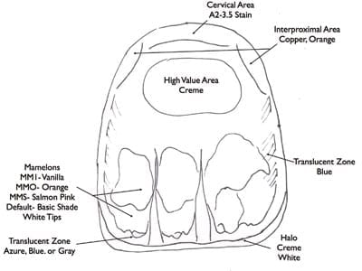 Color map a cosmetic dentist would create