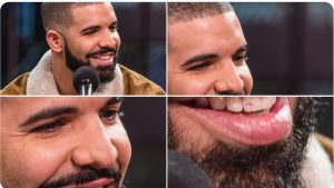 Montage of Drake with close ups of his smile